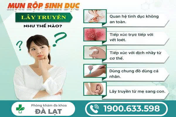 Hình ảnh minh họa